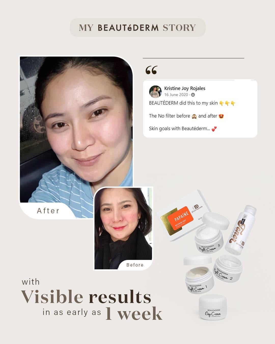 Regular Set with 60 ml toner (2 months’ use)