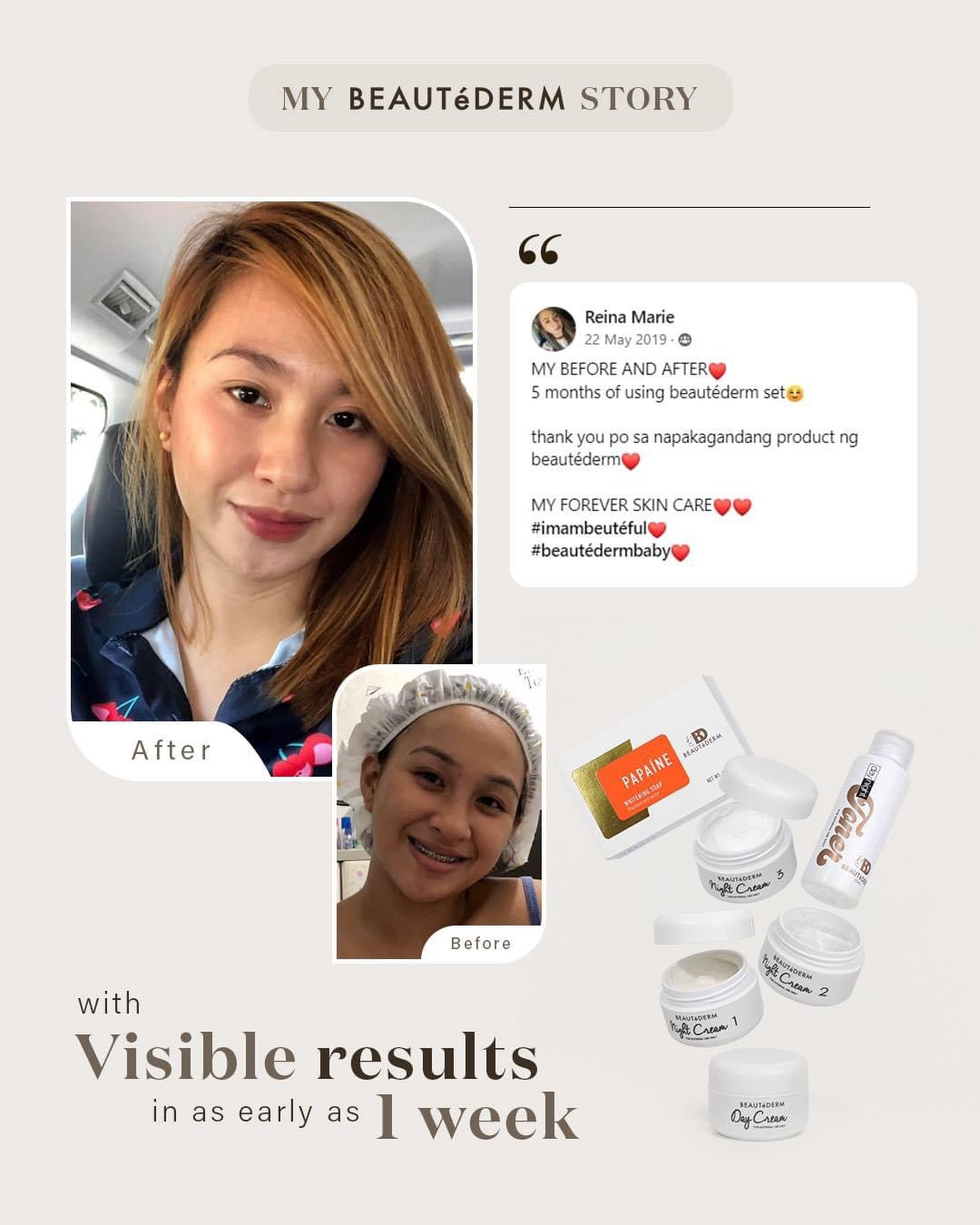 Regular Set with 60 ml toner (2 months’ use)