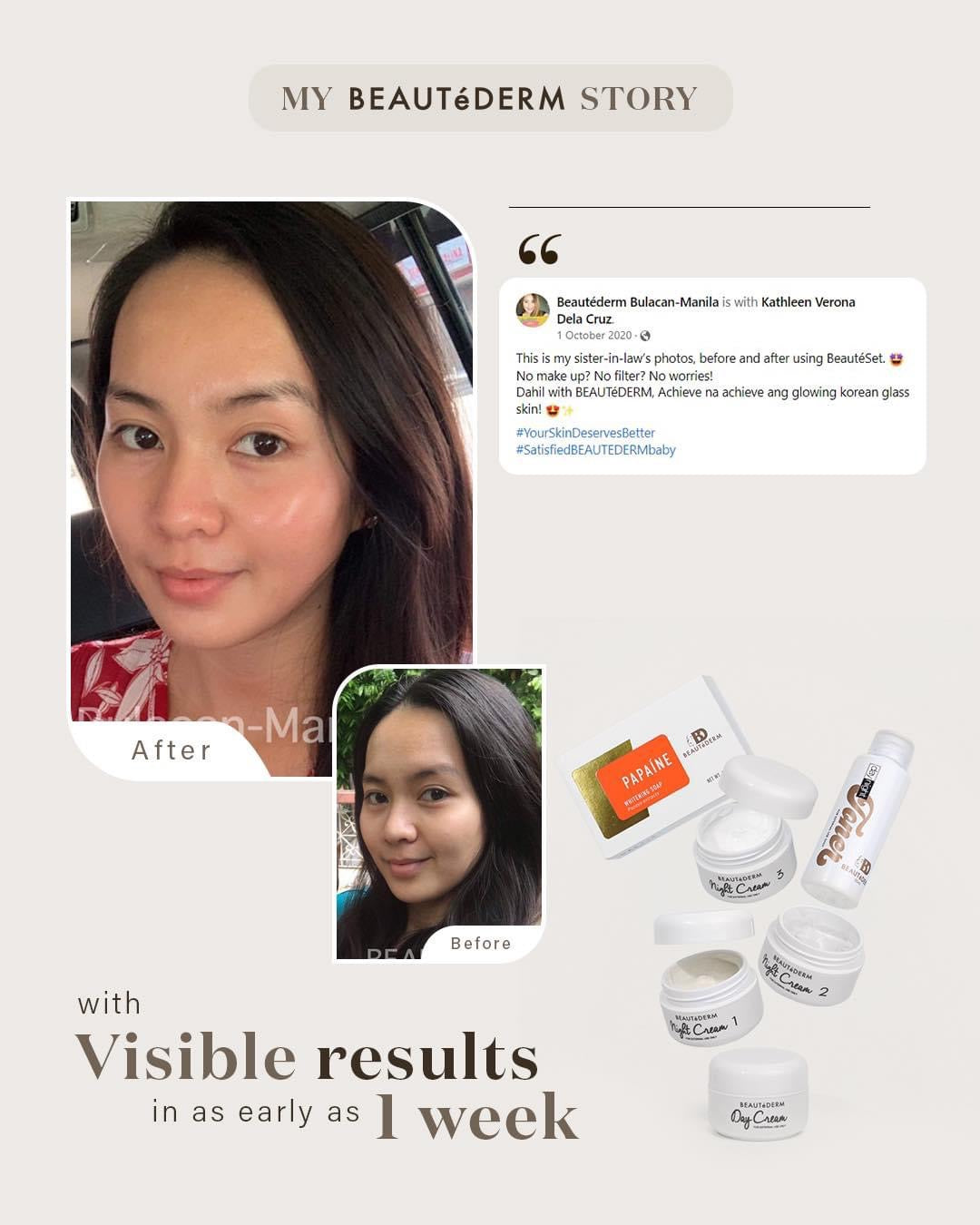 Regular Set with 60 ml toner (2 months’ use)