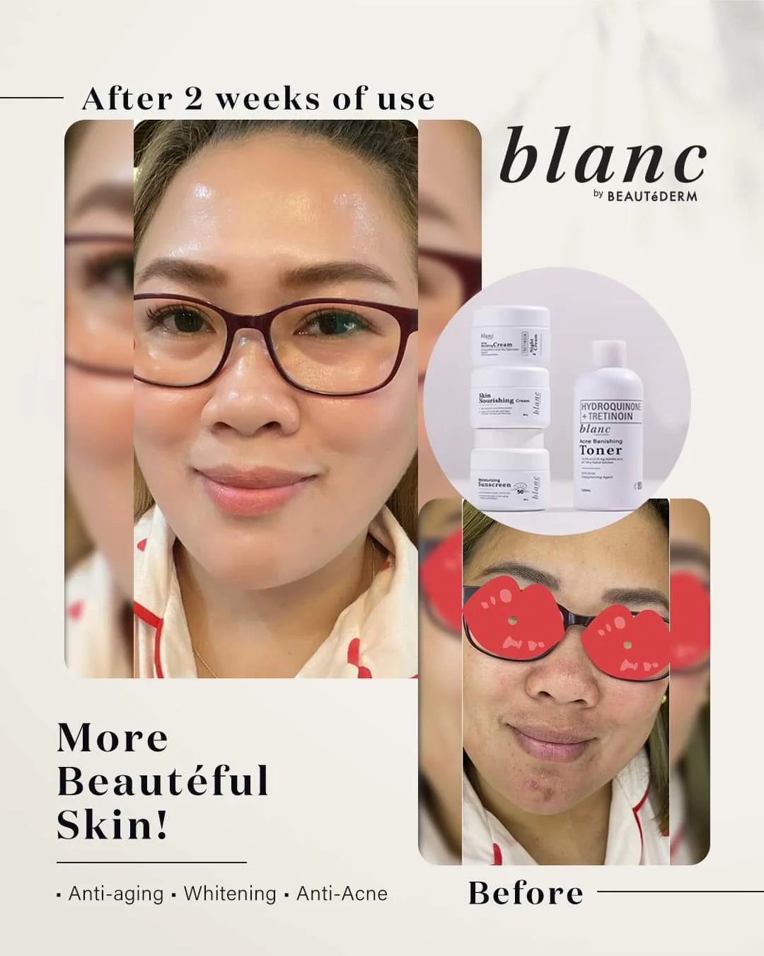 Blanc Set TRIAL Size (60ml toner and 10gram creams, 1 month use) with FREE PapaineSoap 150gms and Blanc Pouch