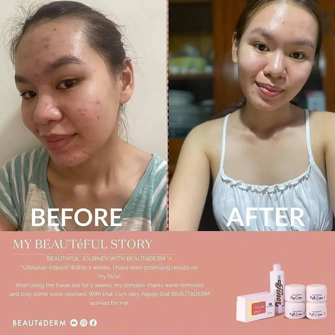 Trial Set* with FREE Day & Night Toner 60ml and Hair Oil