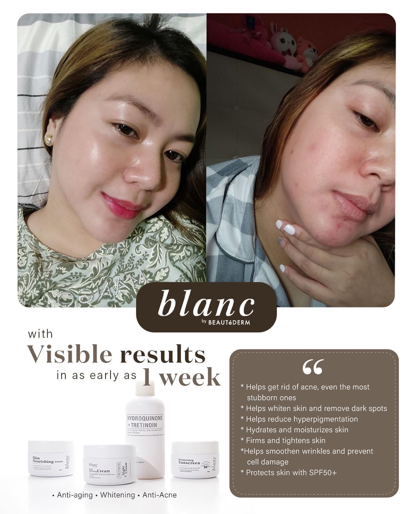 Blanc Set Regular Size (good for 2 months use each one) BUY 1 GET 1 FREE