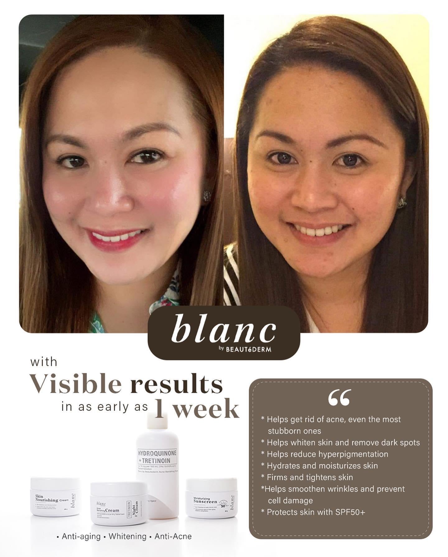 Blanc Set Regular Size (good for 2 months use each one) BUY 1 GET 1 FREE