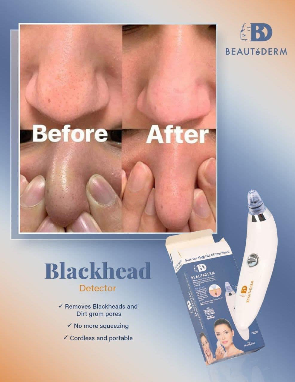 Blackhead Detector