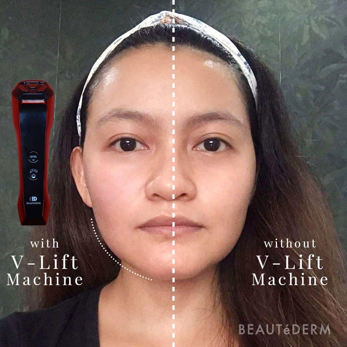 V-lift Machine