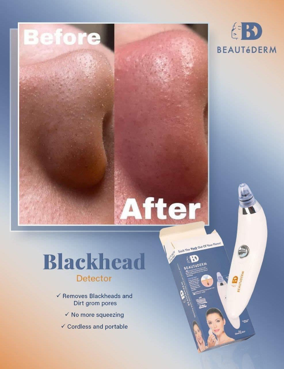 Blackhead Detector