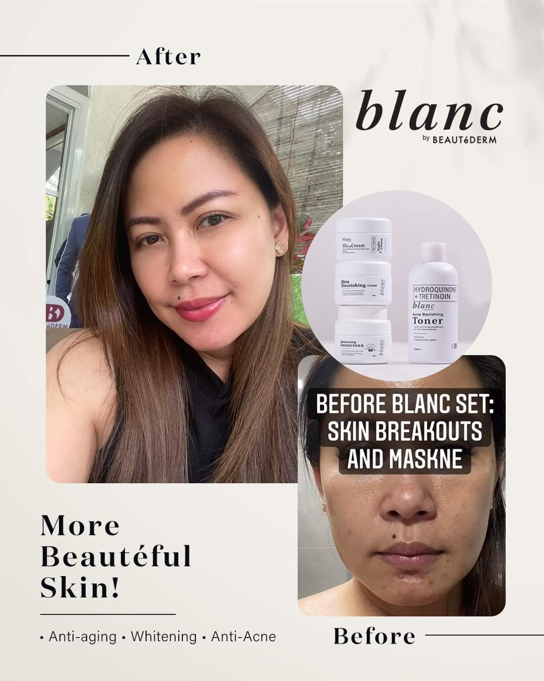 Blanc Acne Banishing Cream 20grams (shelf life 1 year, expiry date 5/2024)